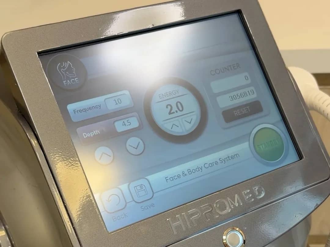 Tela do aparelho HIPRO na Q!Clinic, com os parâmetros de frequência, profundidade e energia