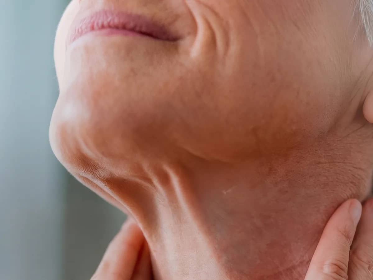 Close do pescoço e da linha da mandíbula de uma mulher, com a pele mostrando perda de firmeza